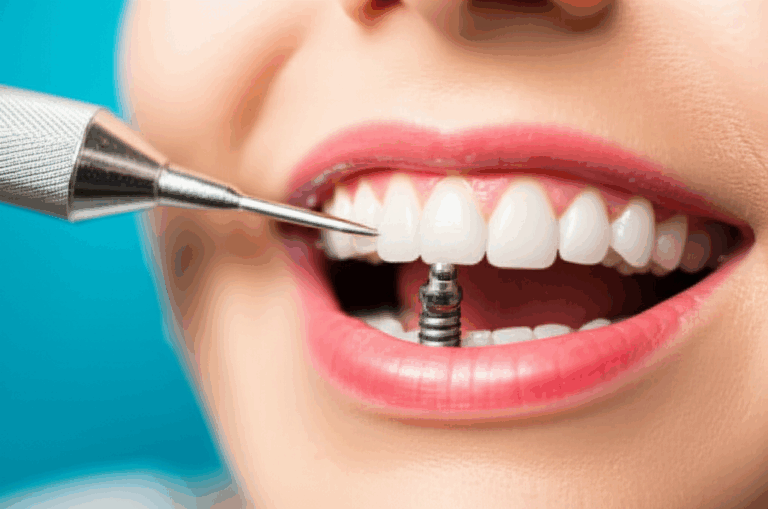 Do Dental Implant Screws Hurt Understanding Pain Discomfort What to Expect