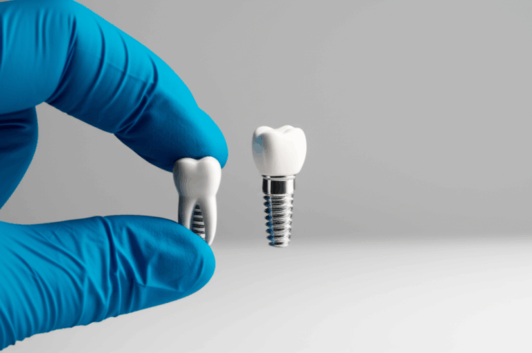 Does Dental Care Plus Cover Dental Implants My Straightforward Guide to Coverage Costs and Choices