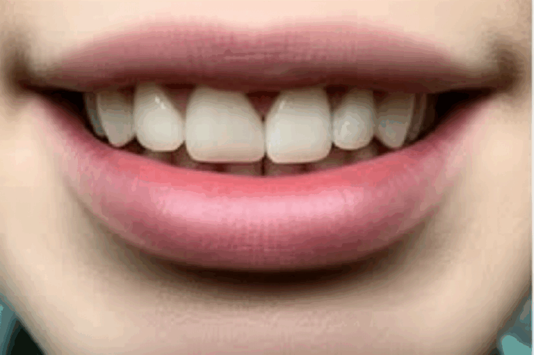 Does MassHealth Cover Dental Implants in Massachusetts Your Simple Guide