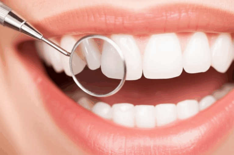 Does Your HMO Cover Dental Implants My First Hand Guide to Coverage Costs and Alternatives